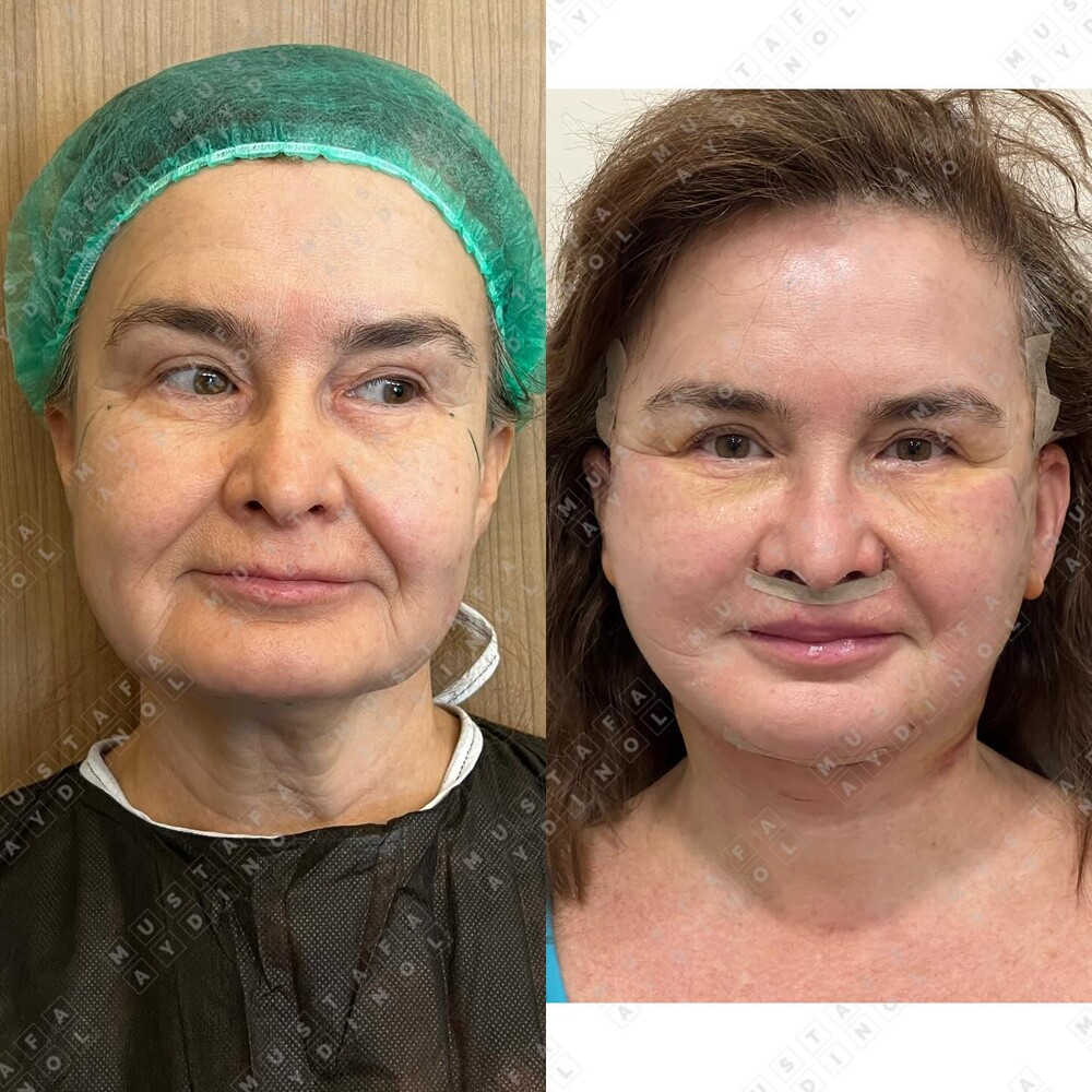 Clinic Results Gallery